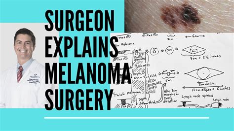 how much is melanoma surgery